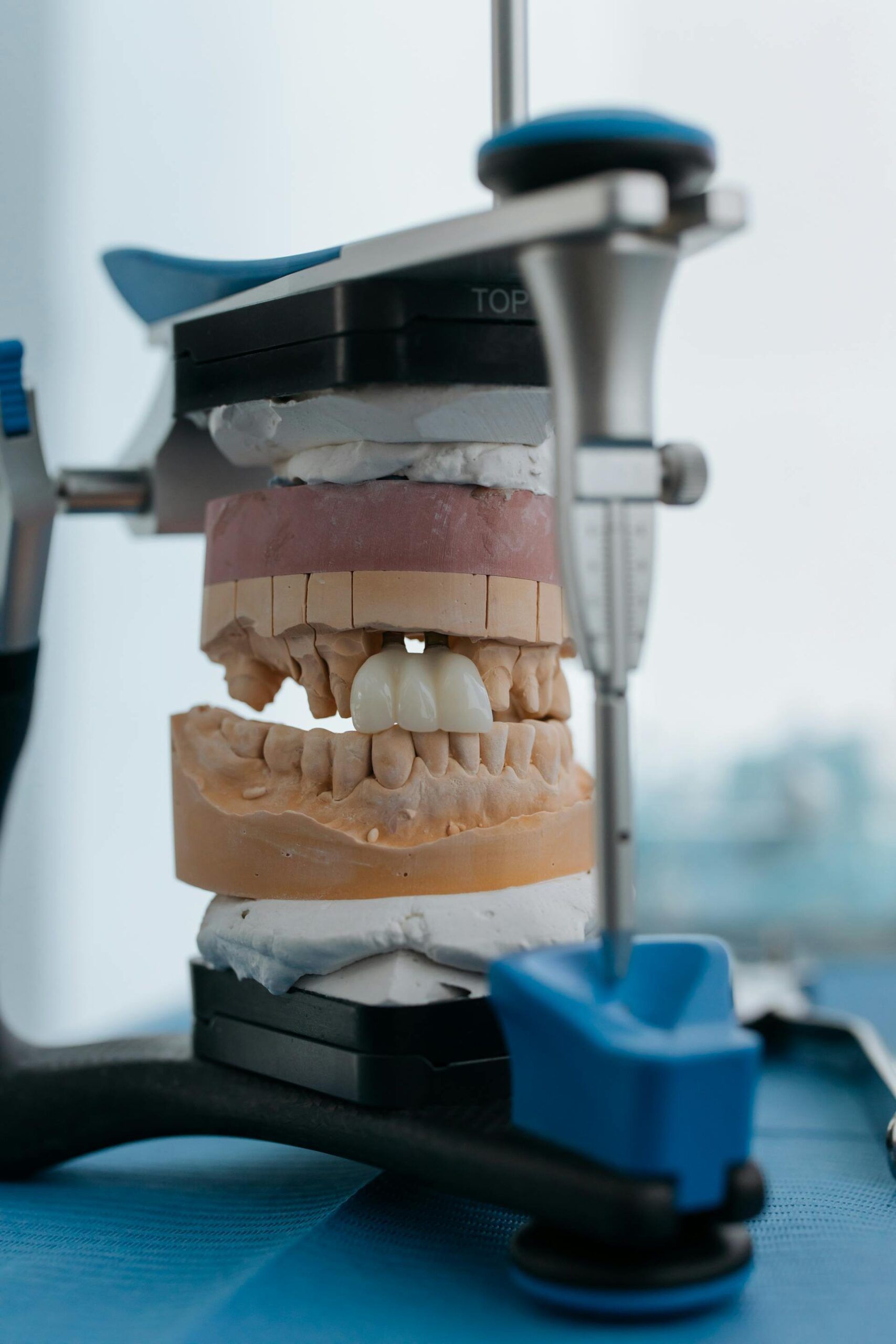 dental crowns