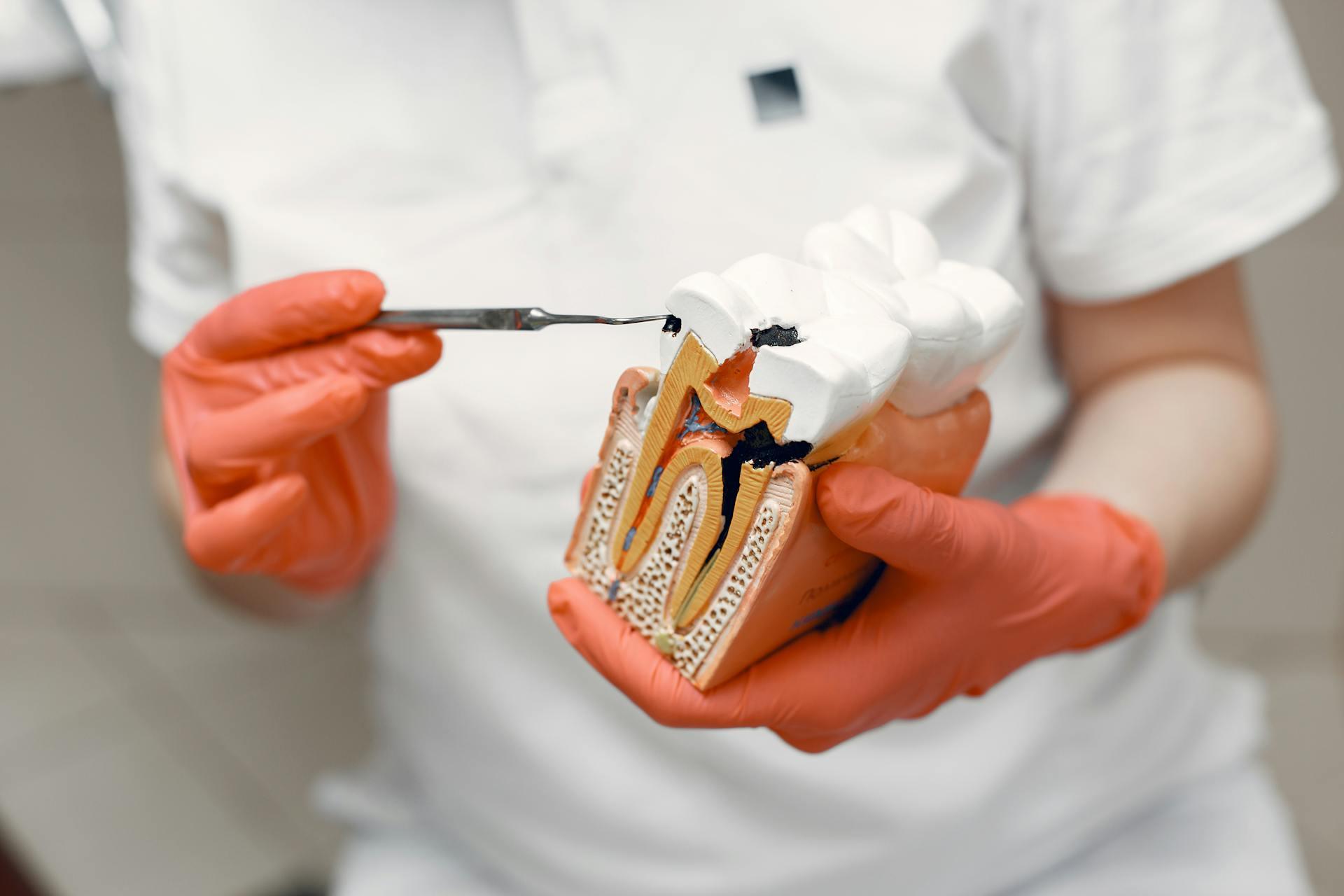 dental crowns